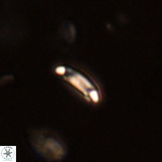 Cruciplacolithus primus VR 01740