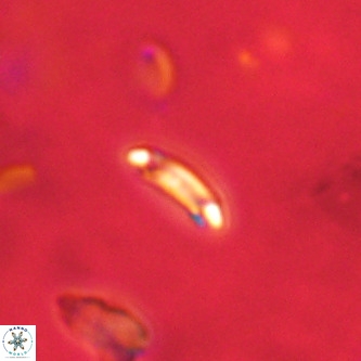 Cruciplacolithus primus VR 01741