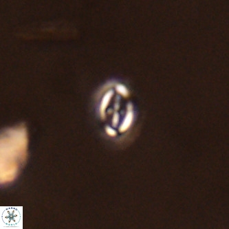 Cruciplacolithus primus VR 01717