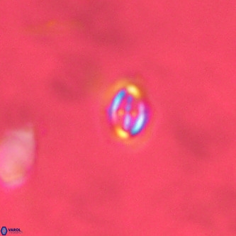 Cruciplacolithus primus VR 01718