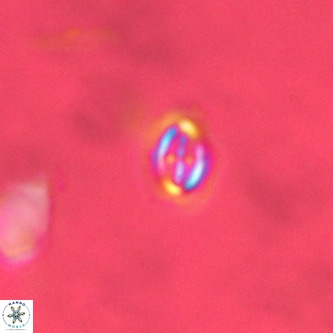 Cruciplacolithus primus VR 01718