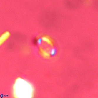 Cruciplacolithus primus VR 01720