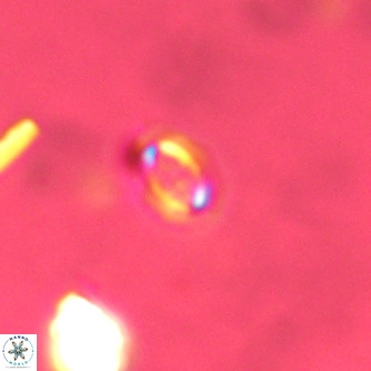 Cruciplacolithus primus VR 01720