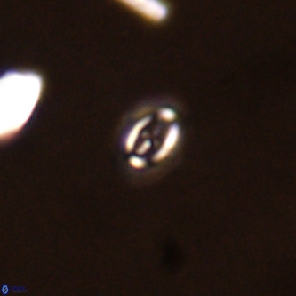 Cruciplacolithus primus VR 01721