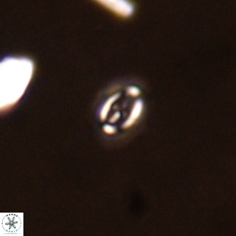Cruciplacolithus primus VR 01721