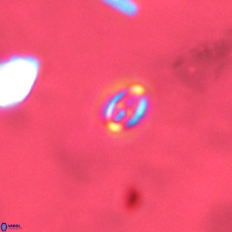 Cruciplacolithus primus VR 01722