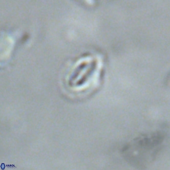 Cruciplacolithus primus VR 01727