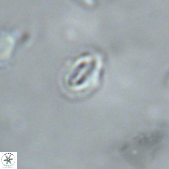 Cruciplacolithus primus VR 01727