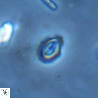 Cruciplacolithus primus VR 01728