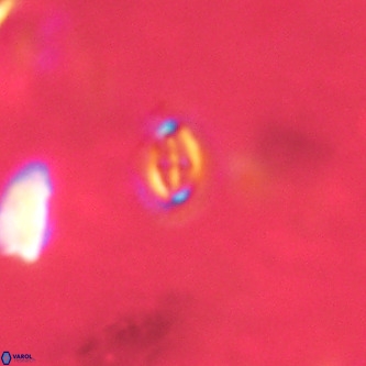 Cruciplacolithus primus VR 01731