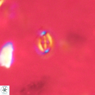 Cruciplacolithus primus VR 01731