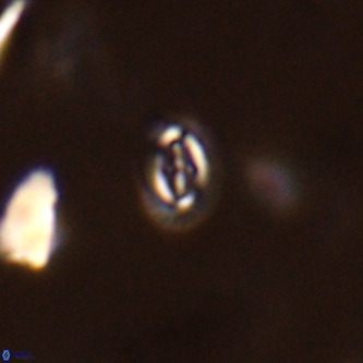 Cruciplacolithus primus VR 01733