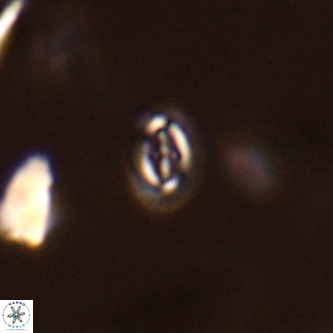 Cruciplacolithus primus VR 01733
