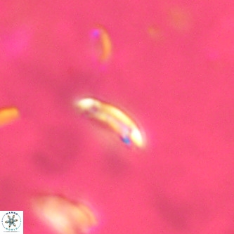 Cruciplacolithus primus VR 01735