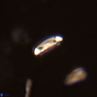 Cruciplacolithus primus VR 01737