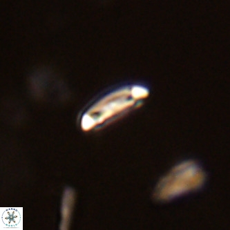 Cruciplacolithus primus VR 01737