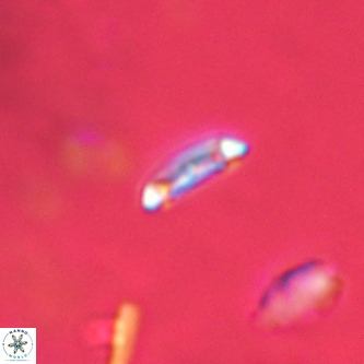 Cruciplacolithus primus VR 01739