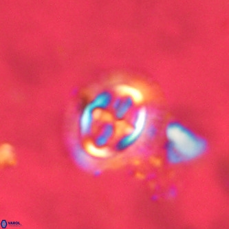 Cruciplacolithus primus large VR 02058