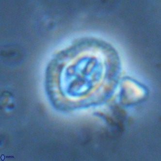 Cruciplacolithus primus large VR 02060