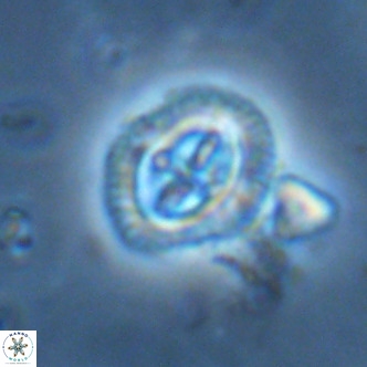 Cruciplacolithus primus large VR 02060