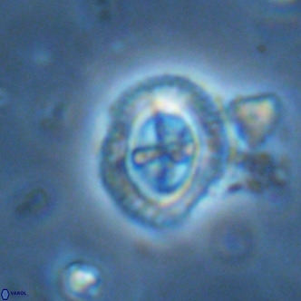 Cruciplacolithus primus large VR 02061