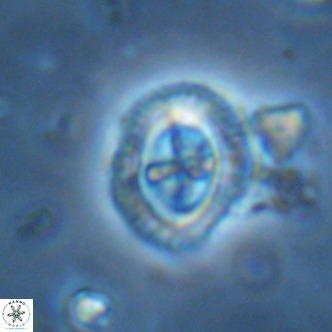 Cruciplacolithus primus large VR 02061