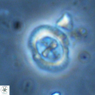 Cruciplacolithus primus large VR 02062