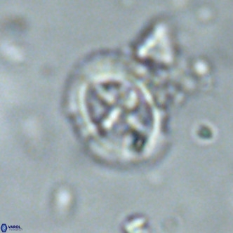 Cruciplacolithus primus large VR 02063