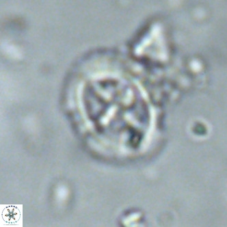 Cruciplacolithus primus large VR 02063
