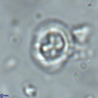 Cruciplacolithus primus large VR 02064