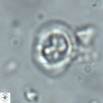 Cruciplacolithus primus large VR 02064