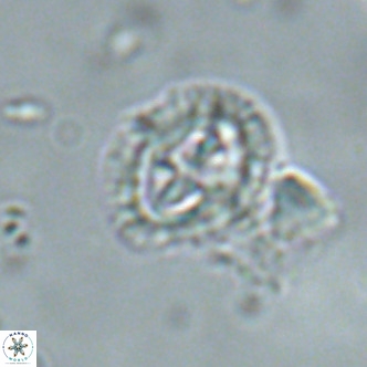 Cruciplacolithus primus large VR 02065