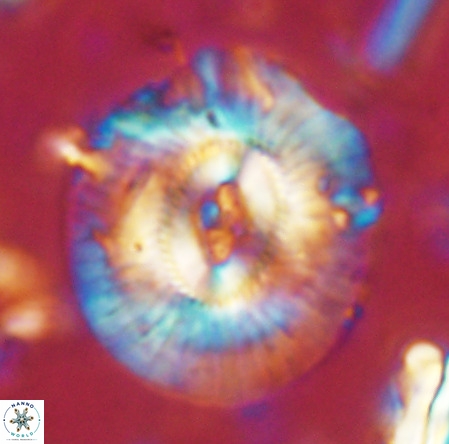 Cruciplacolithus staurion VR 02535