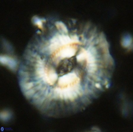 Cruciplacolithus staurion VR 02539