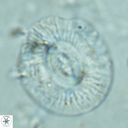 Cruciplacolithus staurion VR 02544