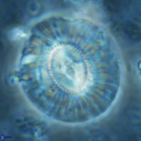 Cruciplacolithus staurion VR 02545