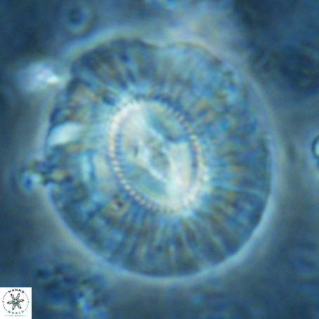 Cruciplacolithus staurion VR 02545