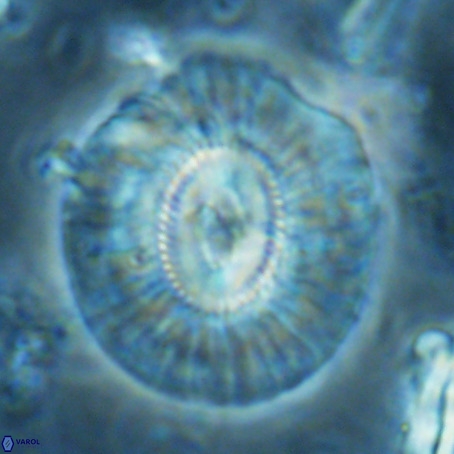 Cruciplacolithus staurion VR 02546