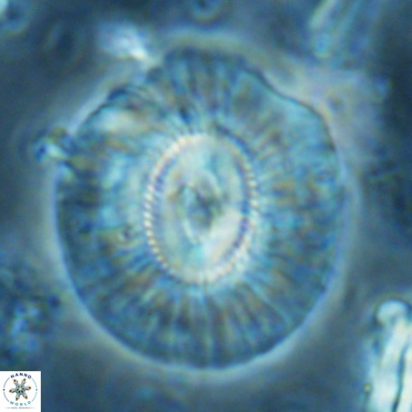 Cruciplacolithus staurion VR 02546