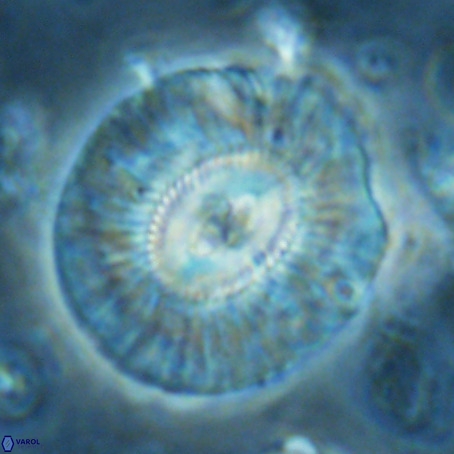 Cruciplacolithus staurion VR 02547