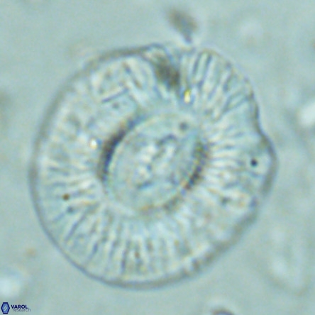 Cruciplacolithus staurion VR 02541