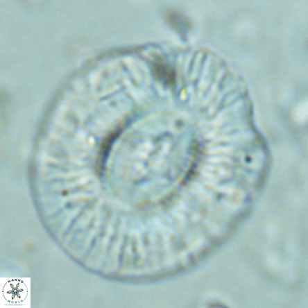 Cruciplacolithus staurion VR 02541