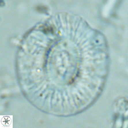 Cruciplacolithus staurion VR 02543