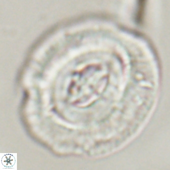 Cruciplacolithus staurion VR 30955