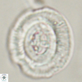 Cruciplacolithus staurion VR 30958