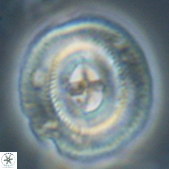 Cruciplacolithus staurion VR 30964