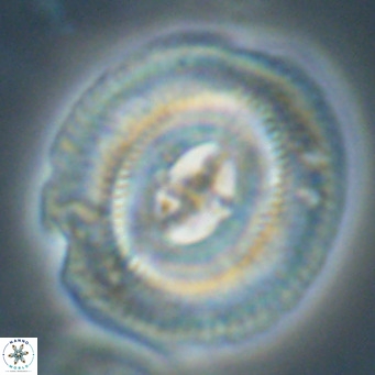 Cruciplacolithus staurion VR 30965