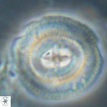 Cruciplacolithus staurion VR 30966