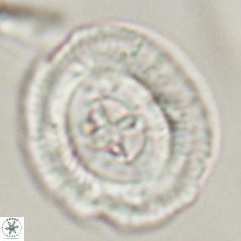 Cruciplacolithus staurion VR 30960