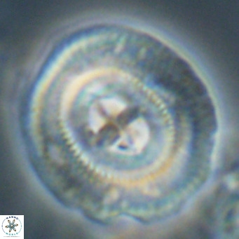 Cruciplacolithus staurion VR 30963